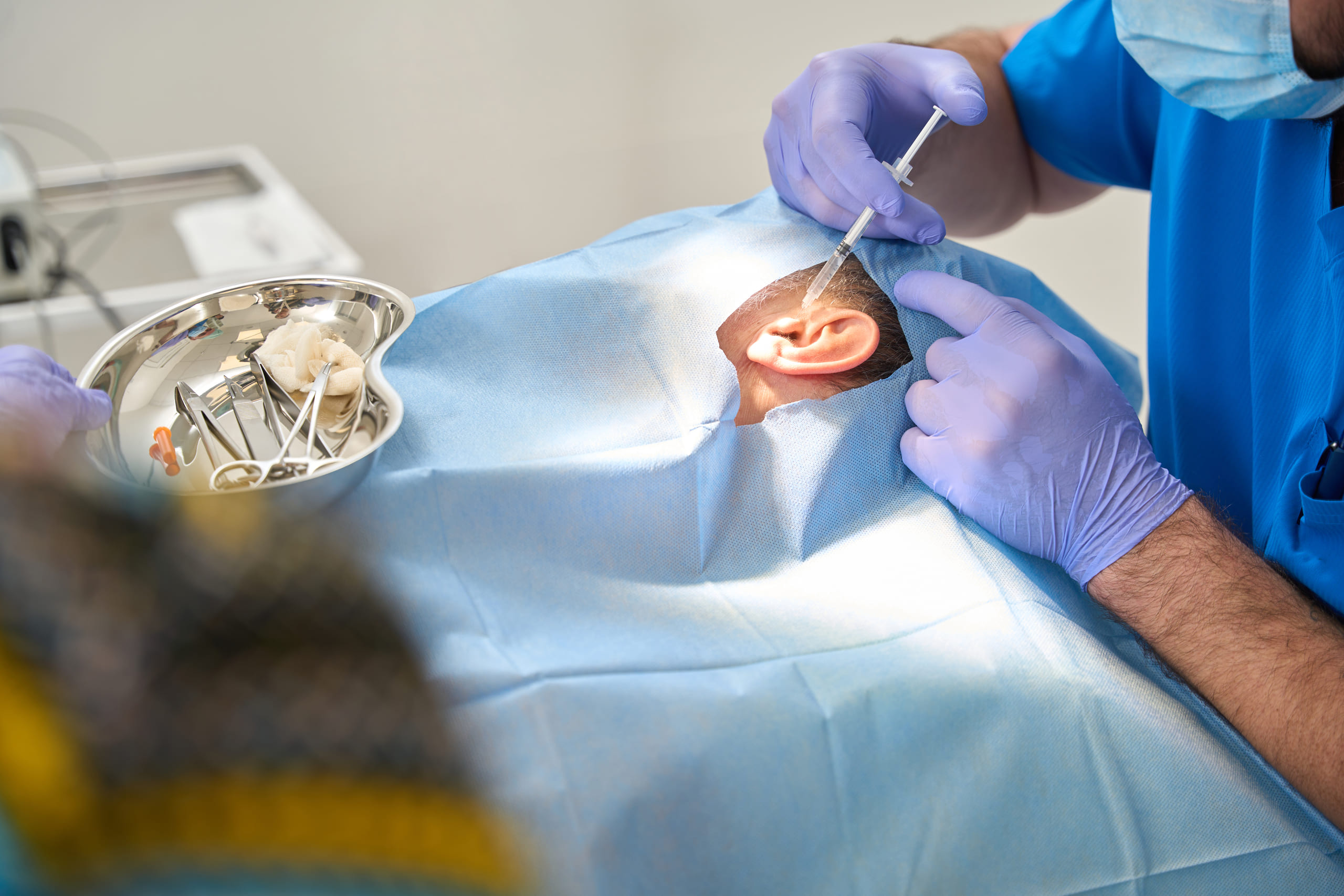 Otoplasty — illustrative archive image